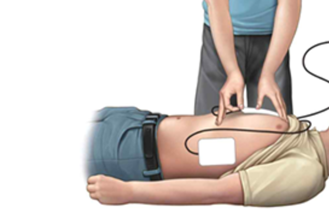 생명을 살리는 심폐소생술 대폭 개선